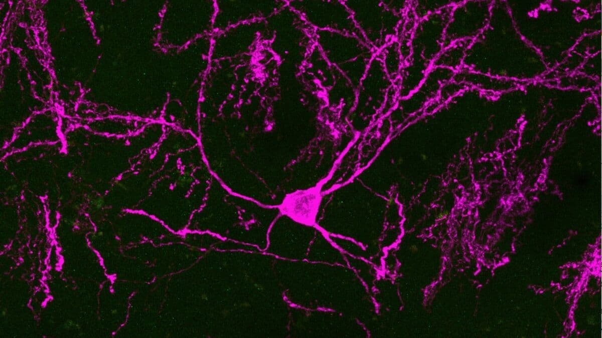 New stem cell study raises hopes for Parkinson’s treatment