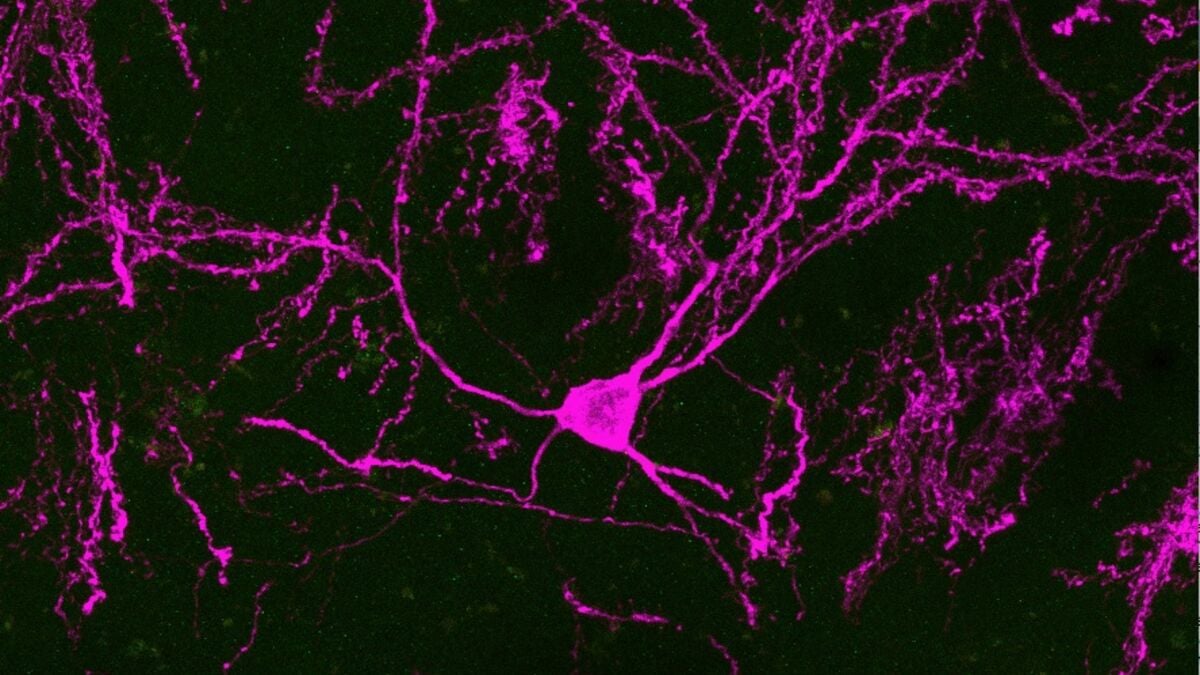 New stem cell study raises hopes for Parkinson’s treatment