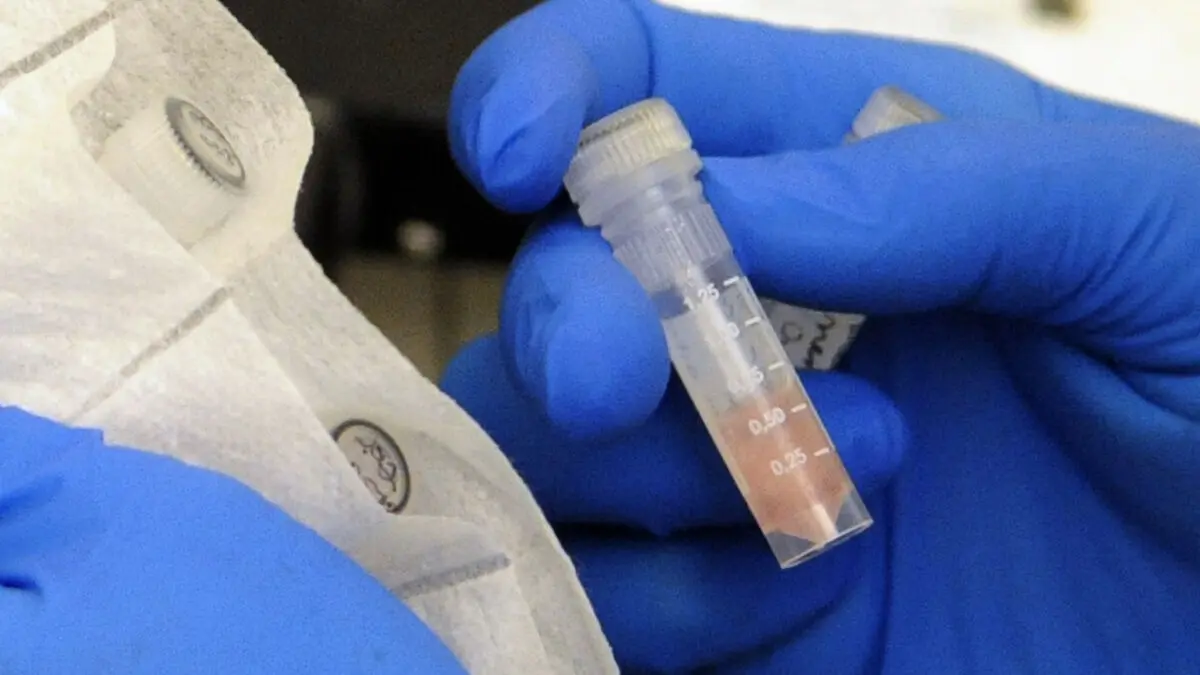 More British cases of meningitis as Canterbury nightclub-linked outbreak rises to 20