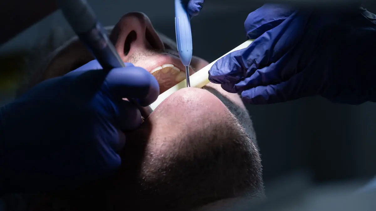 Global ban on amalgam in dentistry