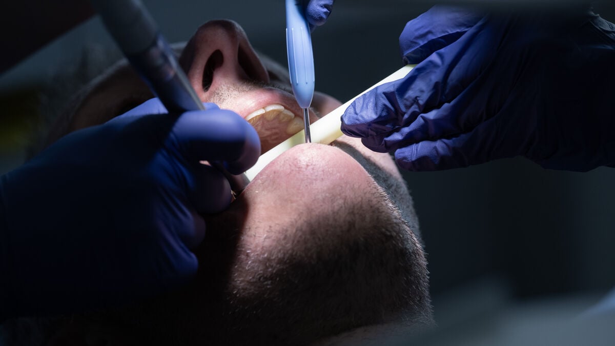 Global ban on amalgam in dentistry