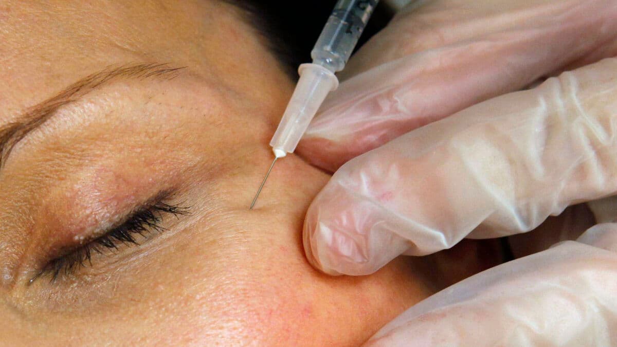 Six hospitalized after serious Botox poisoning, Danish authorities warn