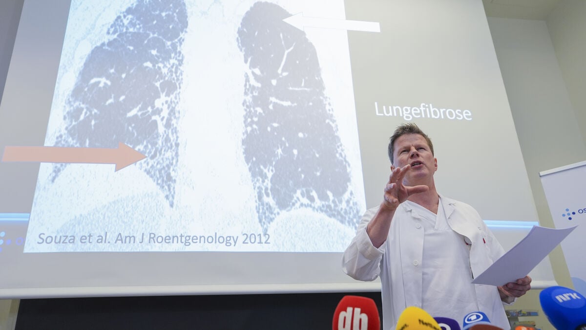 Mette-Marit has received new lungs - Here's how it works
