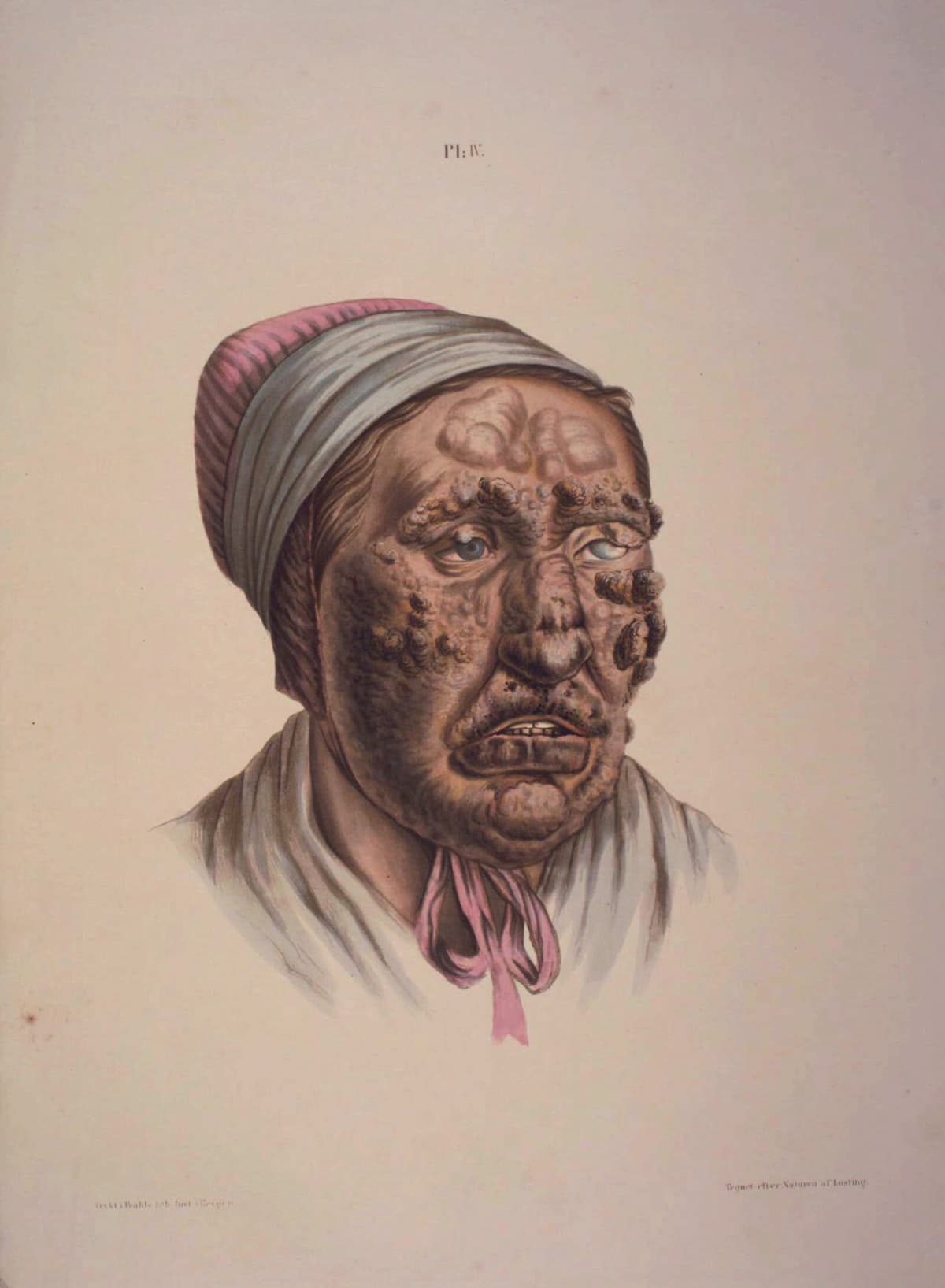 Domestic Animals Linked to Plague and Leprosy Origins, Study Finds