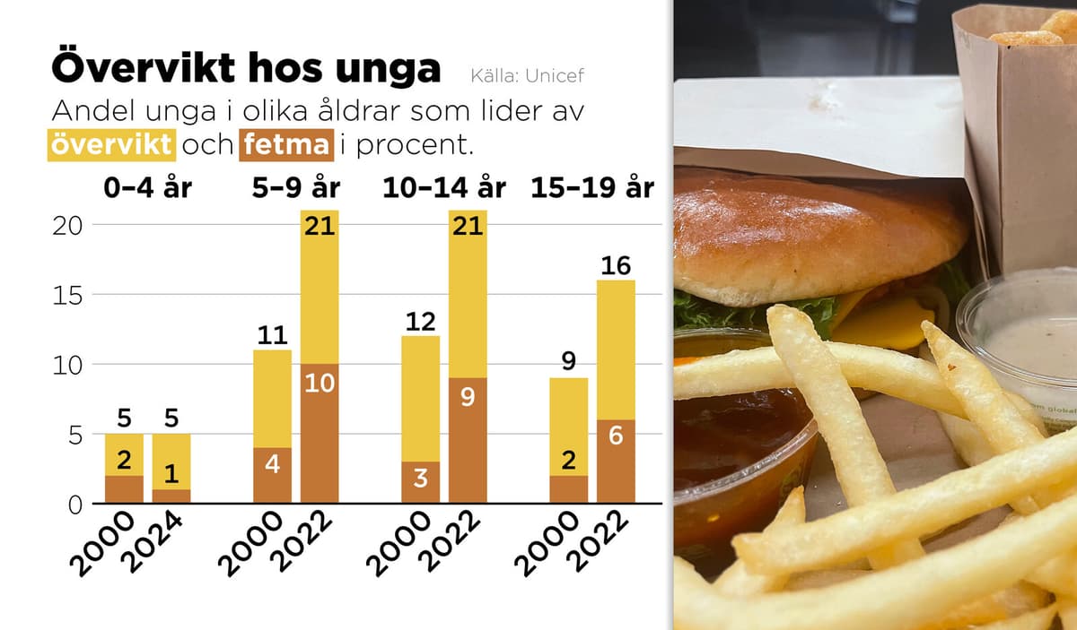 Childhood Obesity Surpasses Malnutrition Globally, Unicef Reports