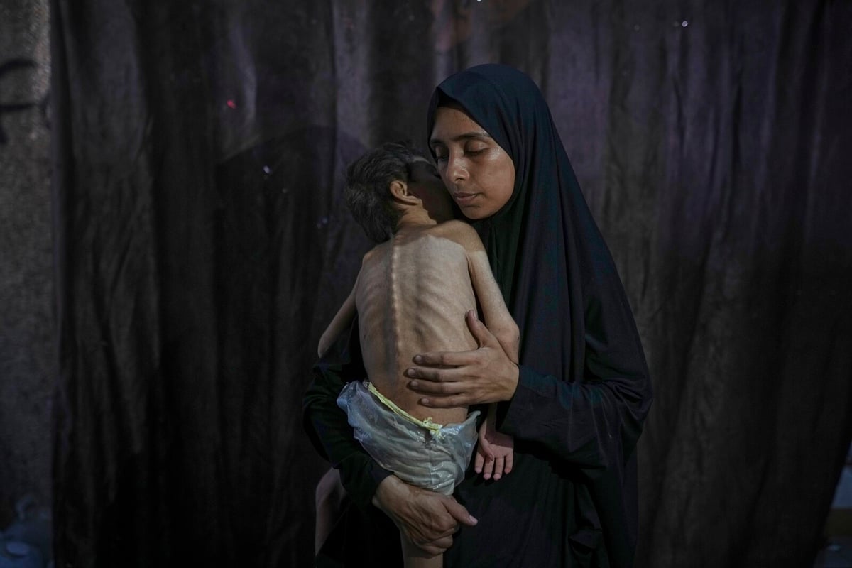 Hunger Crisis in Gaza: Malnutrition Claims More Lives