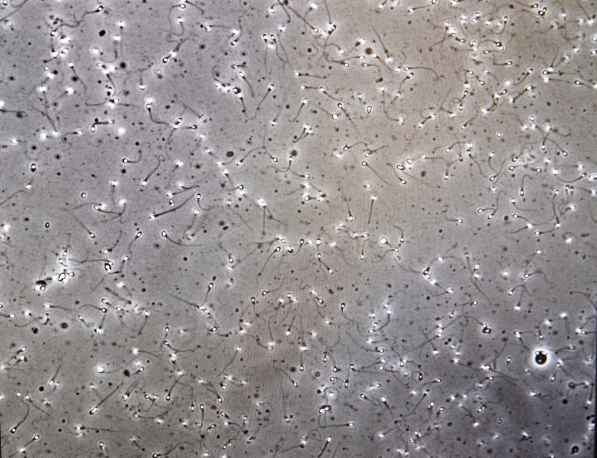 European Court Orders Review of Halland Sperm Theft Responsibility