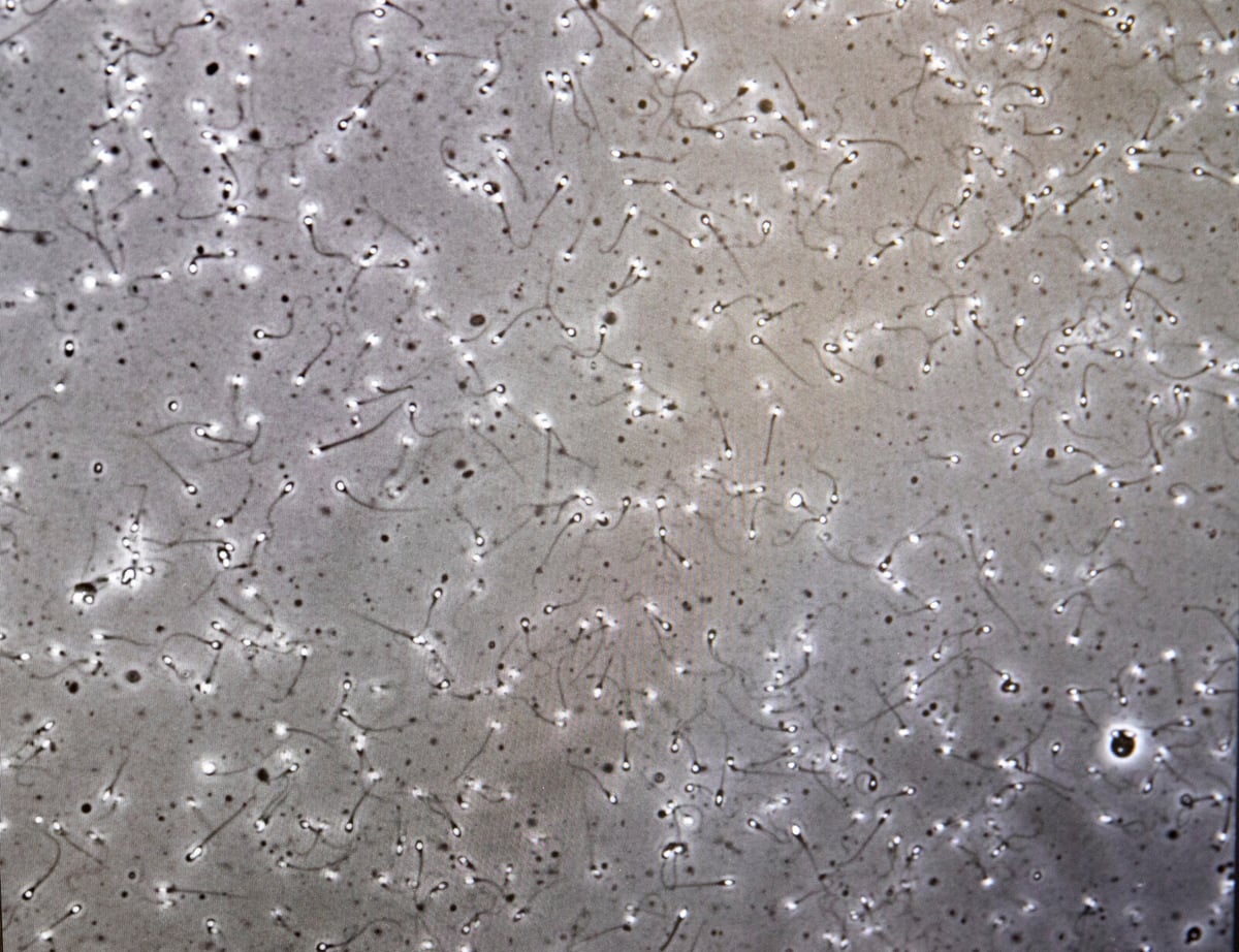 European Court Orders Review of Halland Sperm Theft Responsibility
