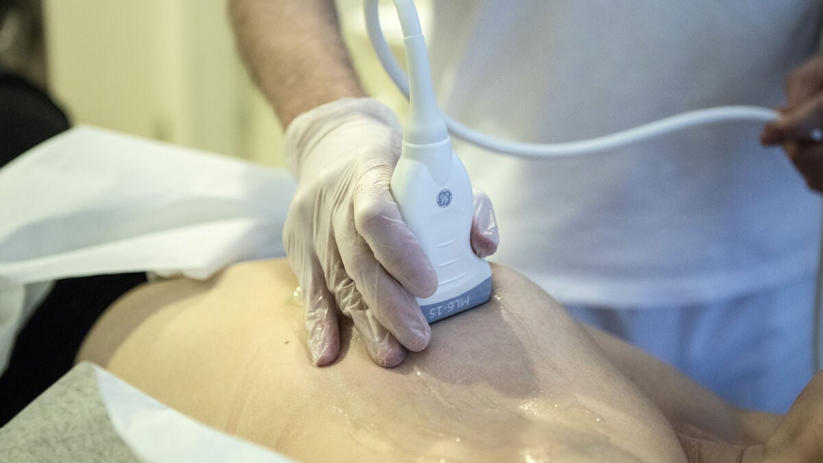 Breast cancer cases continue to rise globally