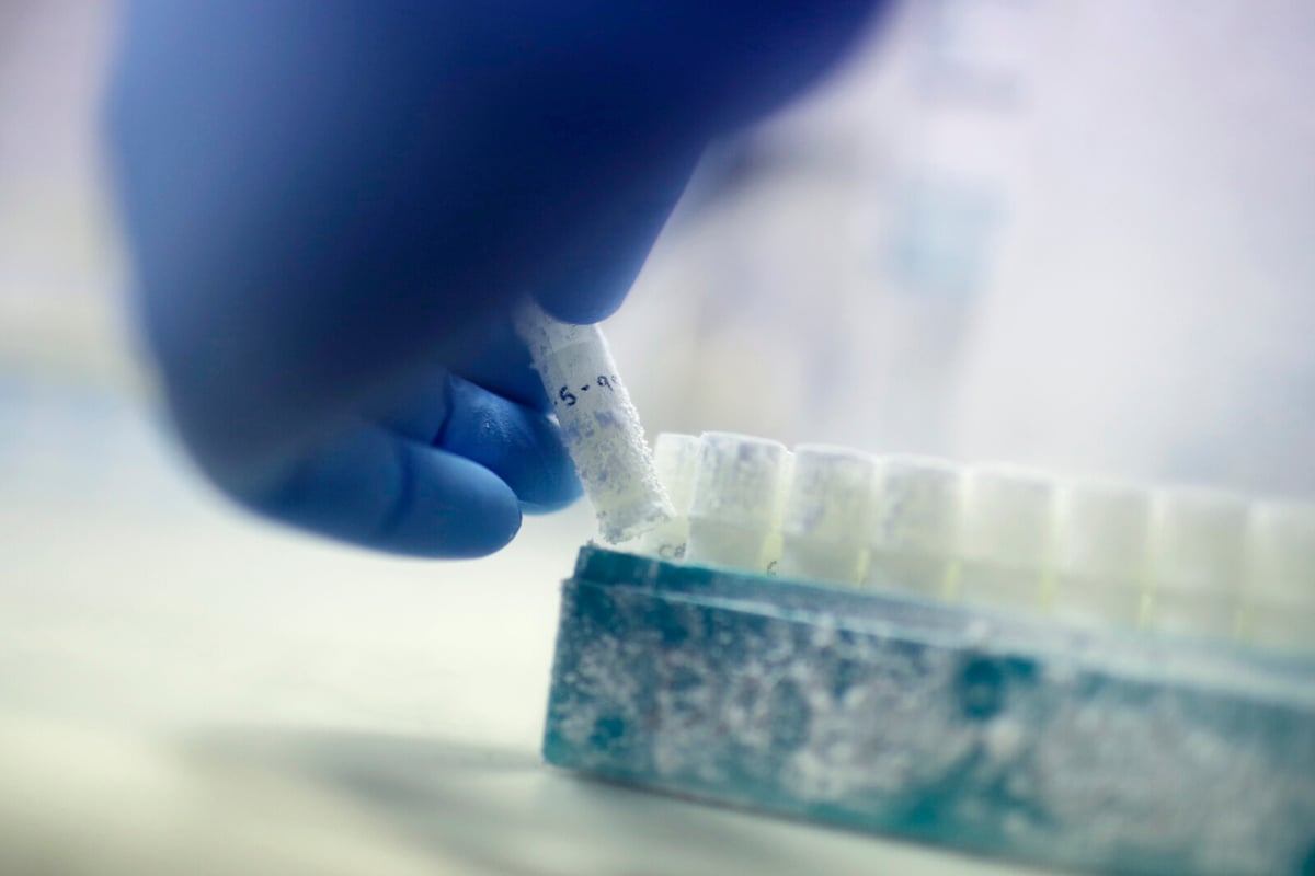 Sperm Donor's Rare Cancer Gene Affects 67 Children in Europe