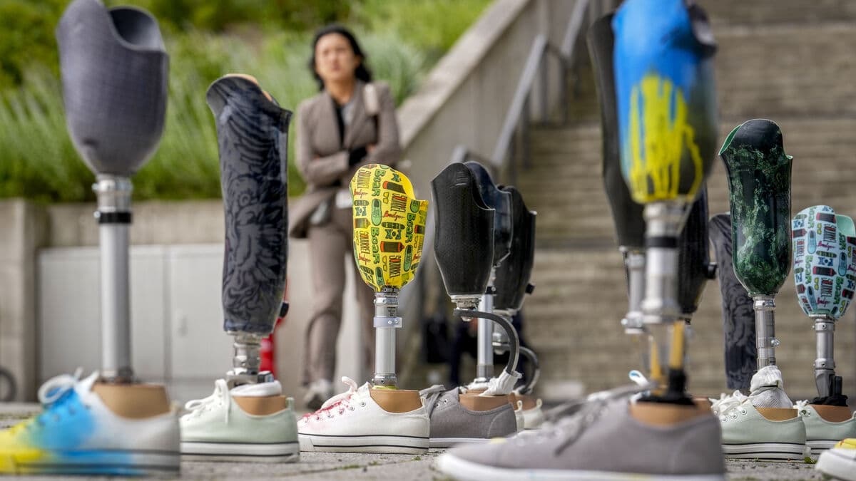 How AI can provide better leg prostheses: Cracked the code