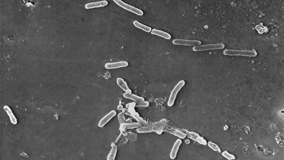 Antibiotic-Resistant Bacteria Infections Surge Globally, Warns WHO