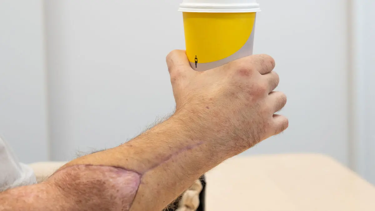 Got two new hands this summer – eats with cutlery