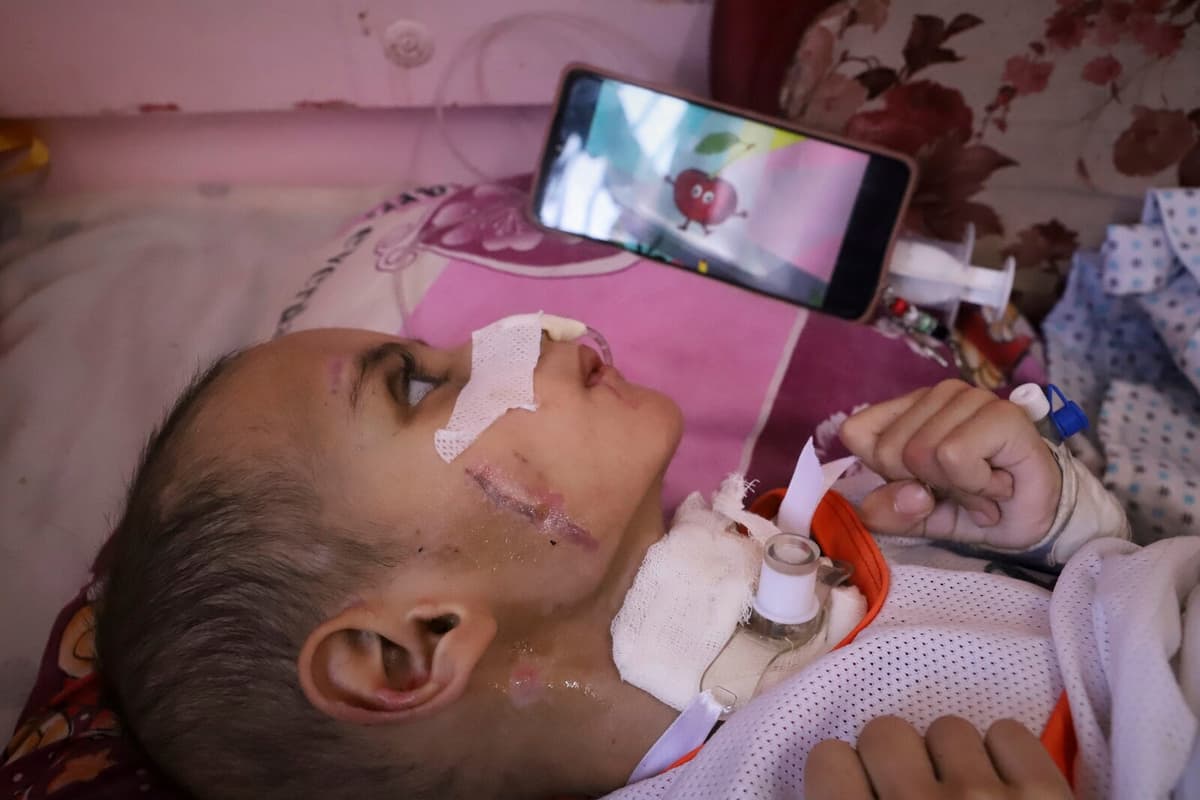 Three-Year-Old Amr in Gaza Struggles for Survival After Air Strike