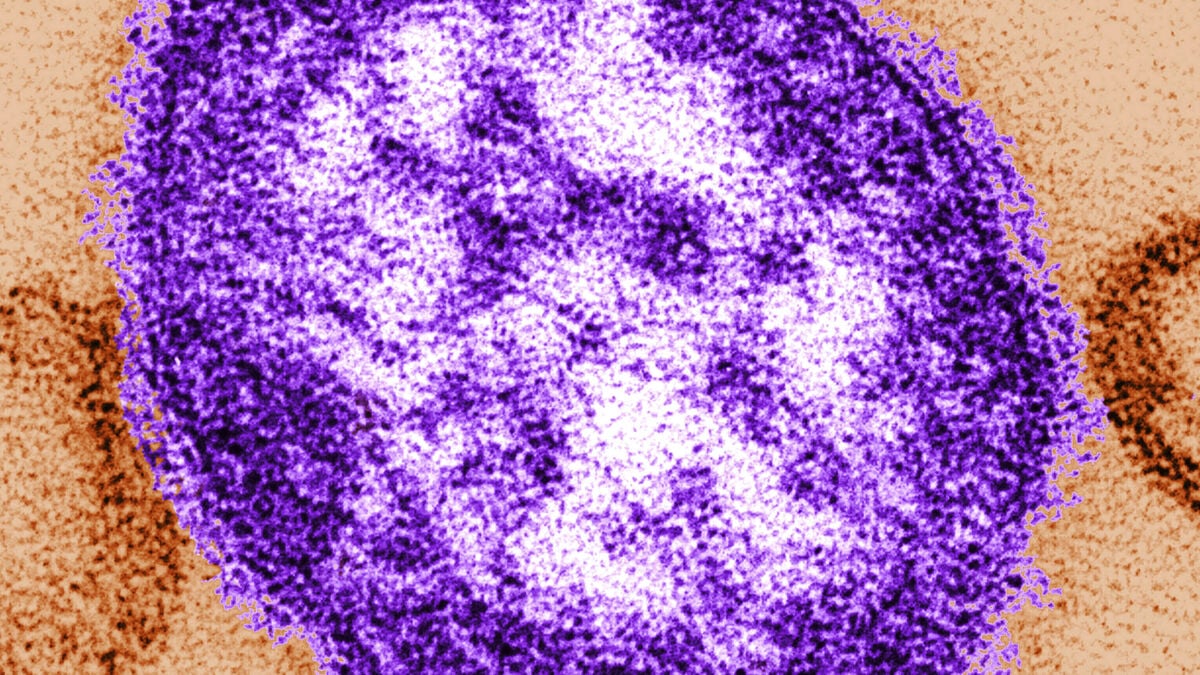 Measles cases rise to 11 in Urkult outbreak, contact tracing under way