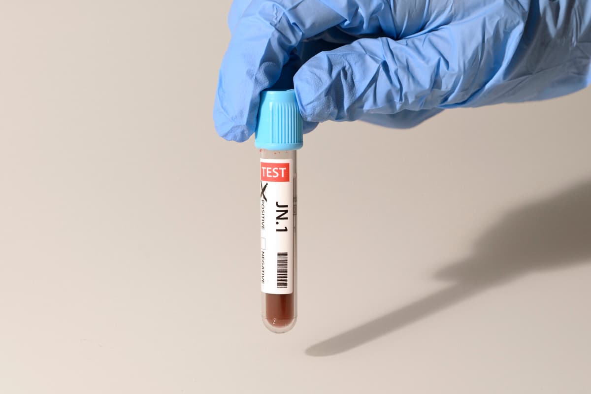 Doctors Highlight Uncertainty in Peth-Test for Driver's License Revocation