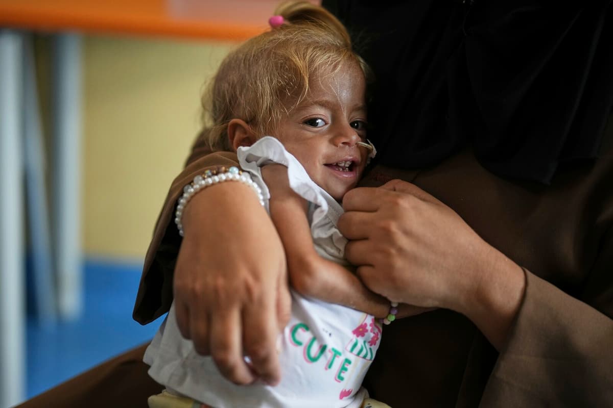 Gaza Toddler Shamm Finds New Hope with Treatment in Italy