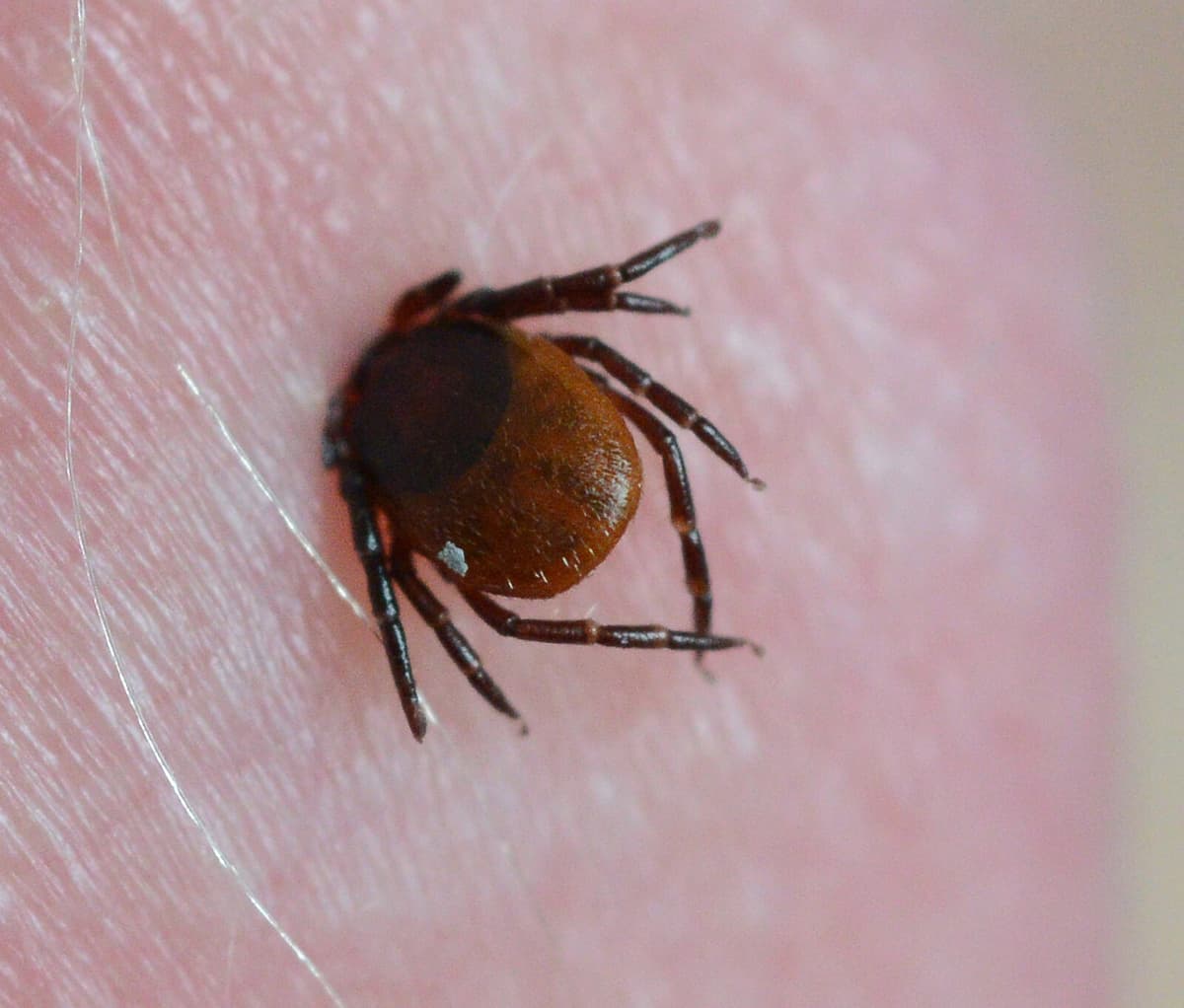 Record TBE Cases Reported This Year with Cause Still Unknown