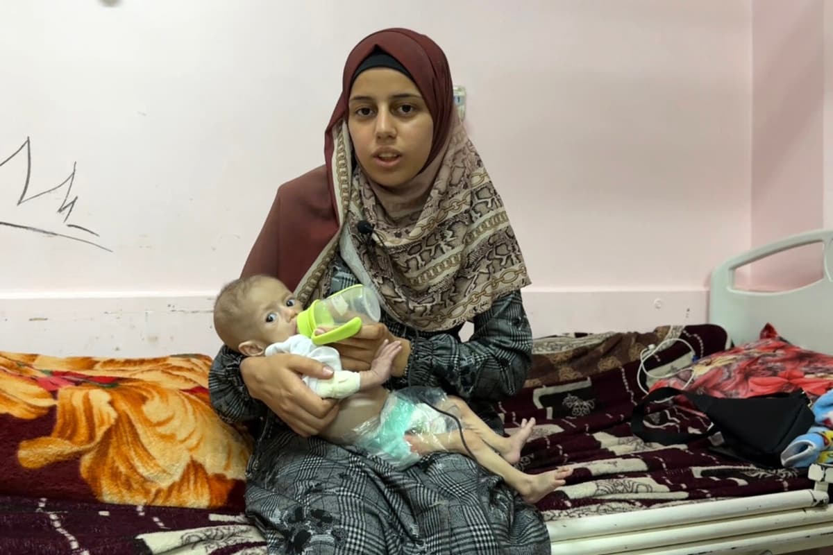 Images of Starvation in Gaza Highlight Severe Humanitarian Crisis