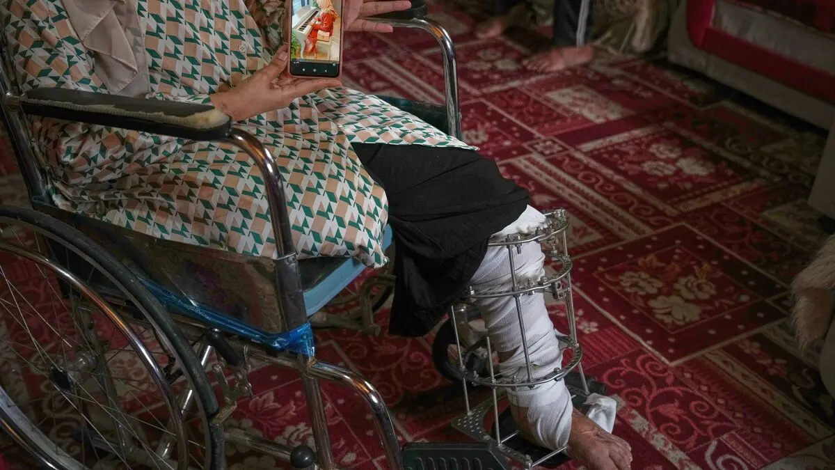 The war took her four daughters – and a leg