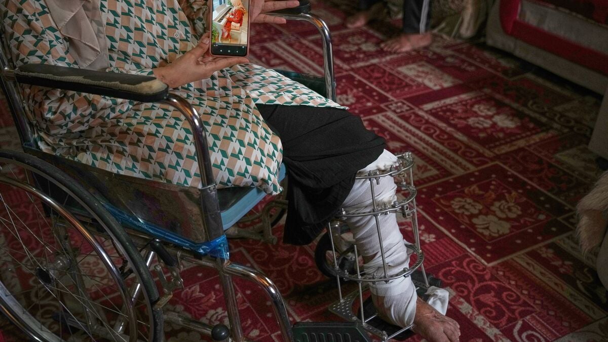 The war took her four daughters – and a leg