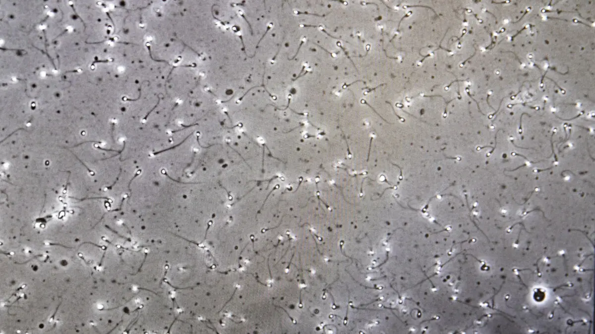 Bengt's sperm was stolen - now he is demanding damages