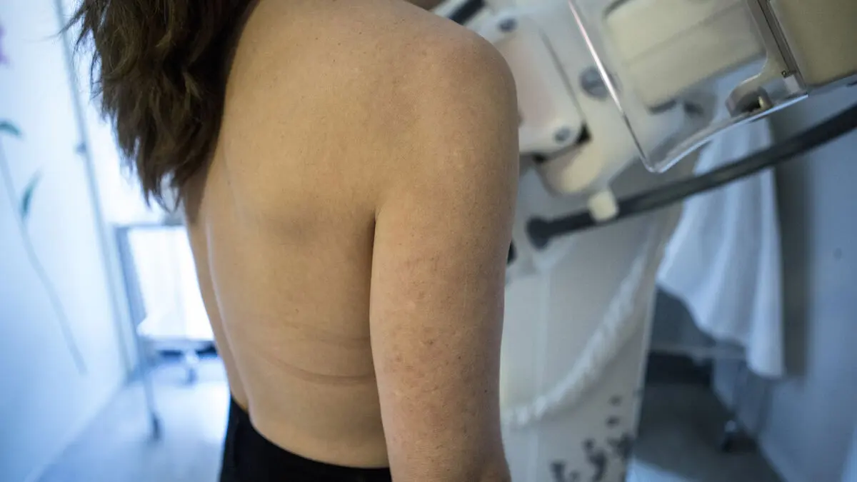 Fewer cases of aggressive breast cancer with AI in screening programs