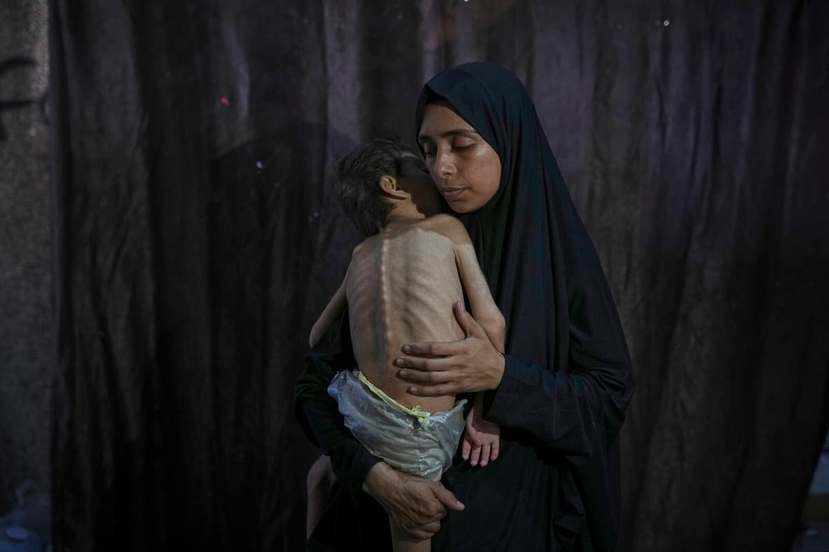 Gaza Crisis: 100 Children Die from Starvation and Malnutrition