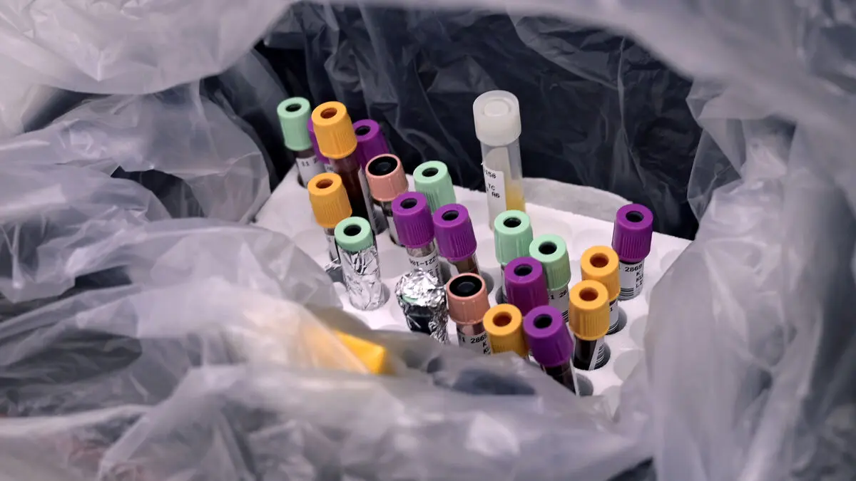 Trouble with test results – patients have to wait longer