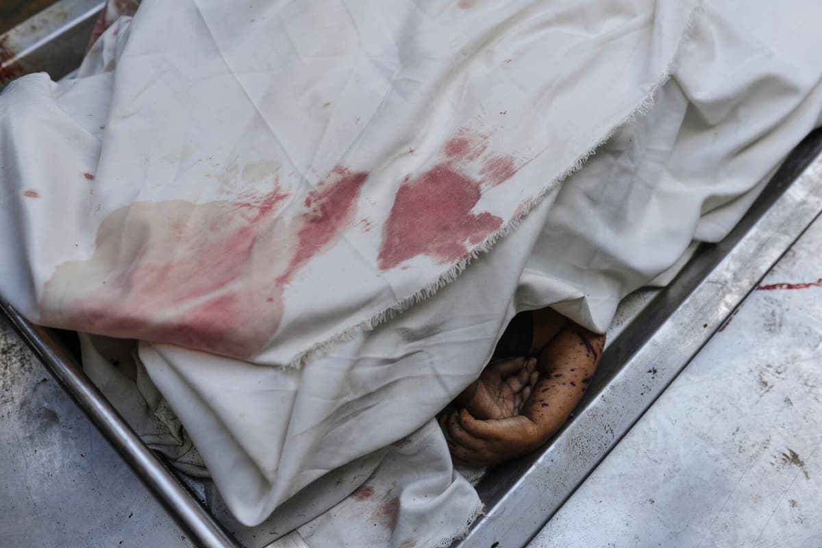 Gaza Hospitals Overwhelmed as Patients Surge Amid Conflict