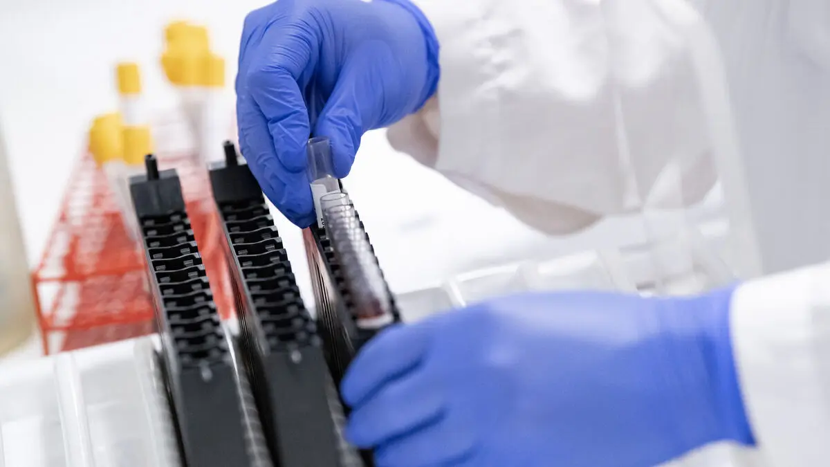 Study: Post-COVID increases risk of cardiovascular disease