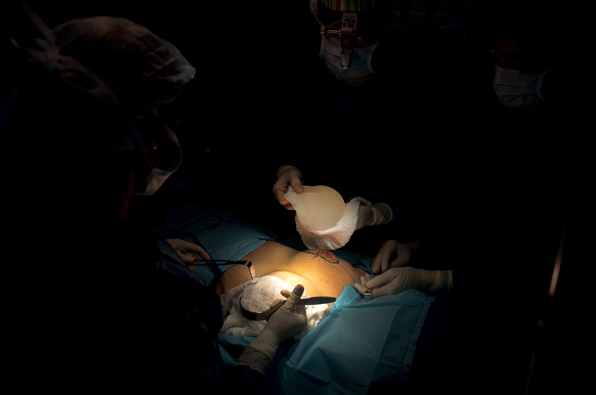 Small Business Owners Frustrated by Sick Pay for Cosmetic Surgery