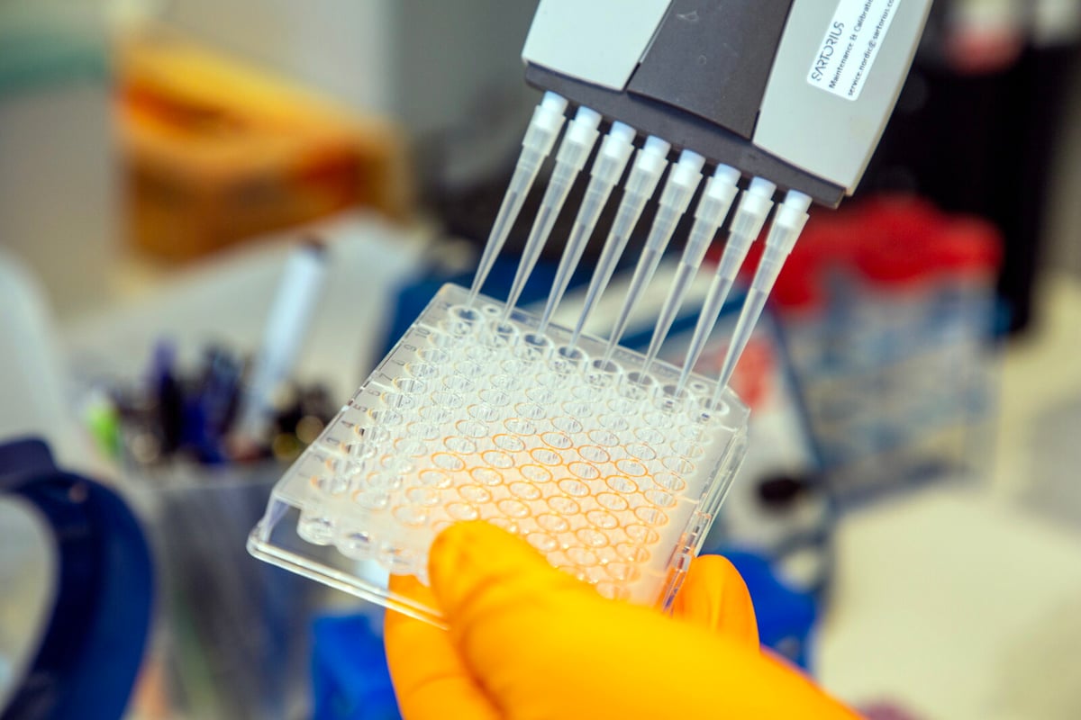 EU Approves Alzheimer's Drug Lecanemab for Sale