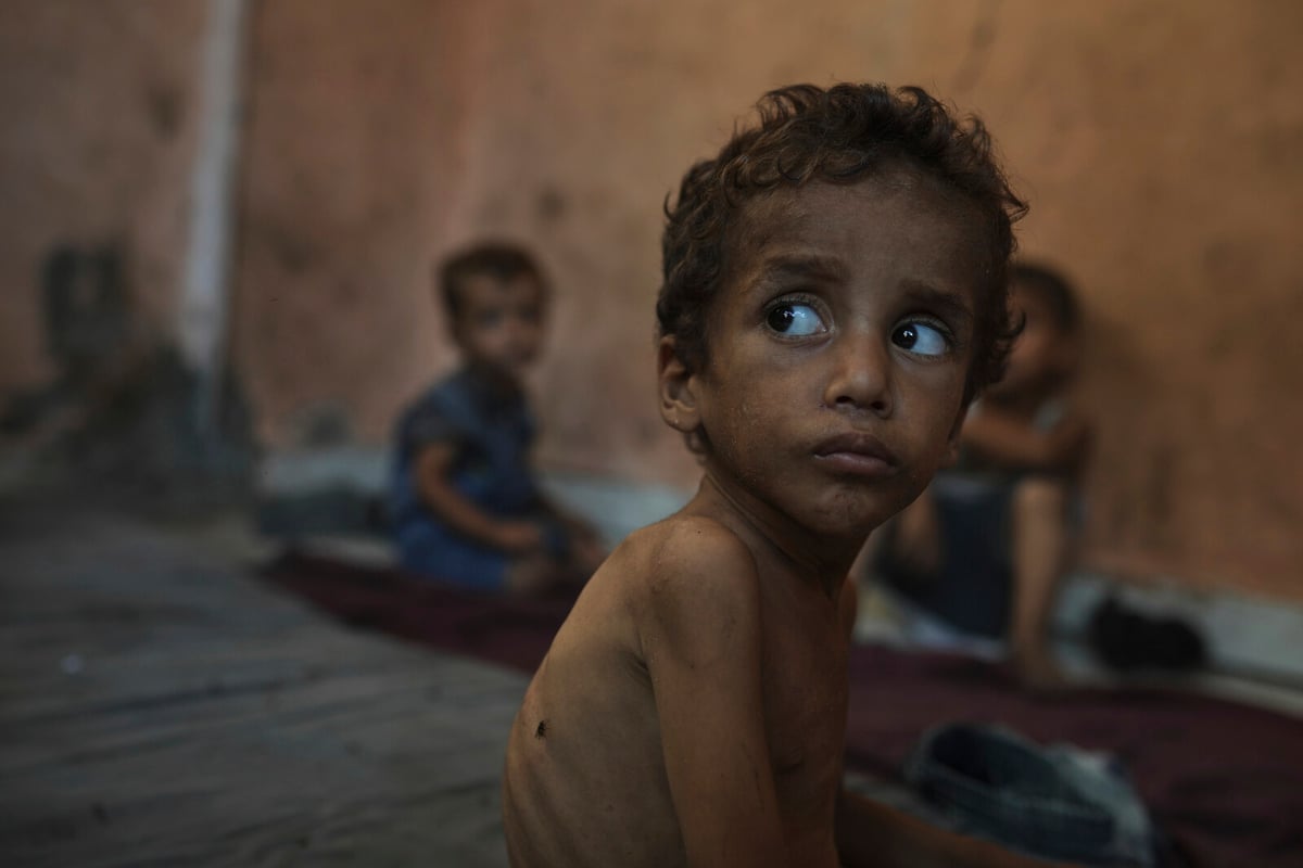 WHO Warns of Alarming Malnutrition Levels in Gaza