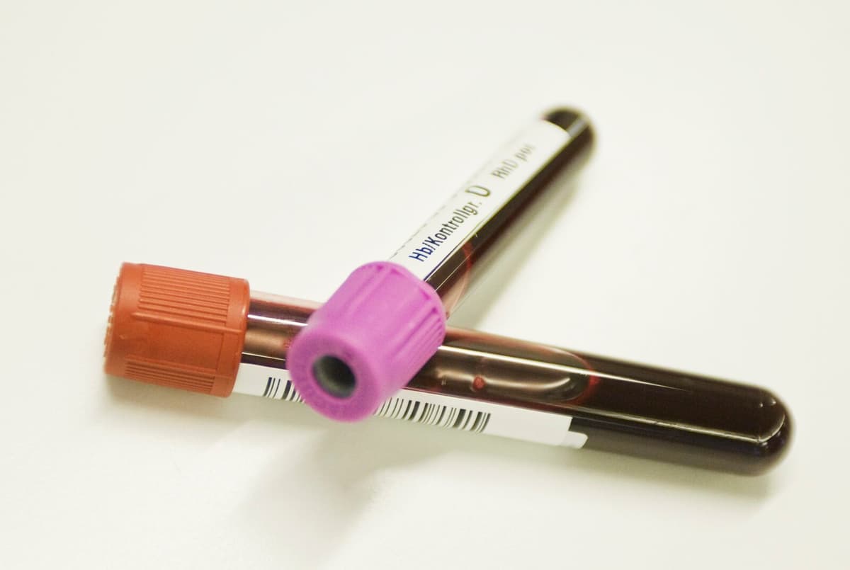 New Blood Group Gwada Negative Discovered by French Researchers