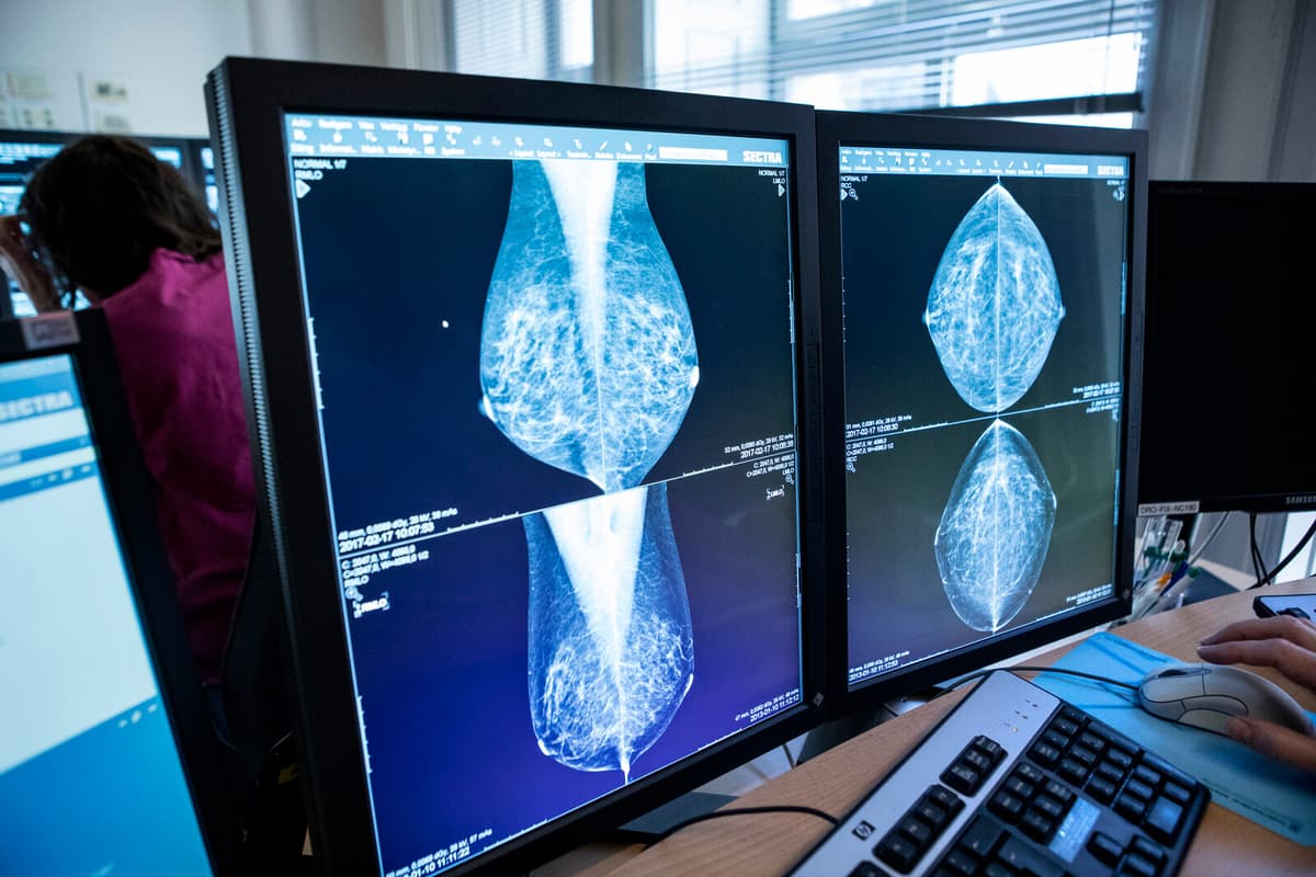 Software Error Led to Misdiagnosed Mammograms in Women