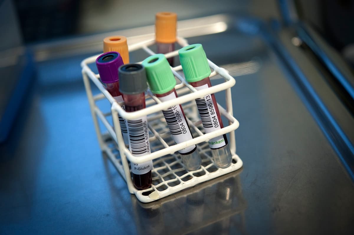 40 Driving Licenses Revoked After Elevated Peth Test Results