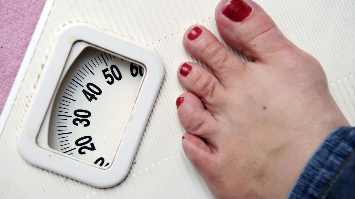 How eating disorders affect you long after diagnosis