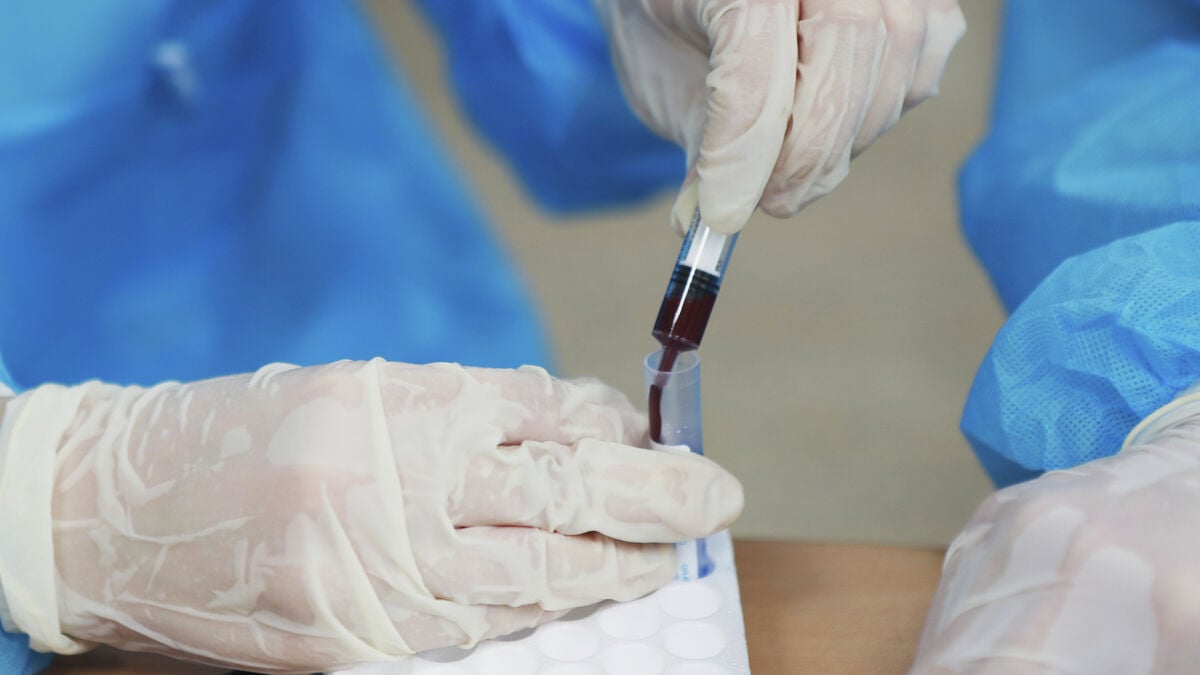Siberian Plague Researcher Dies of Unknown Infection as Nearly 200 Contacts Monitored