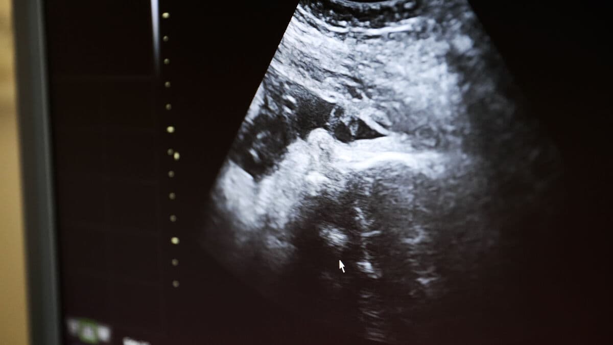 Cube test disappears, replaced in several regions