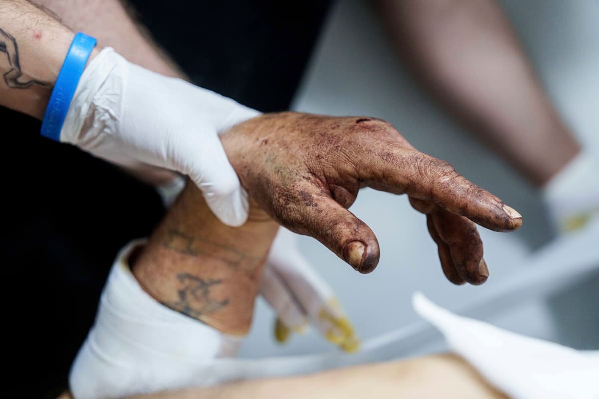 Ukrainian Surgeons Perform Operations in Underground Field Hospital