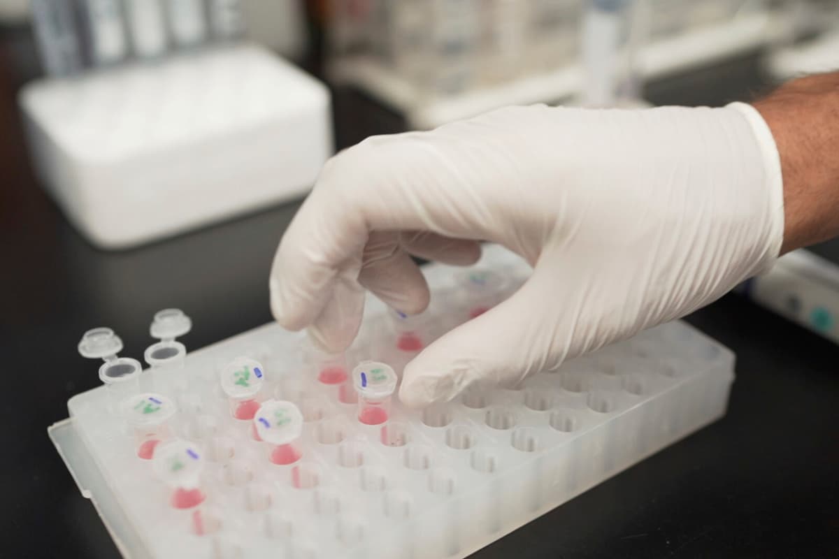 New Alzheimer's-Parkinson's Hybrid Disease Discovered by Swedish Researchers