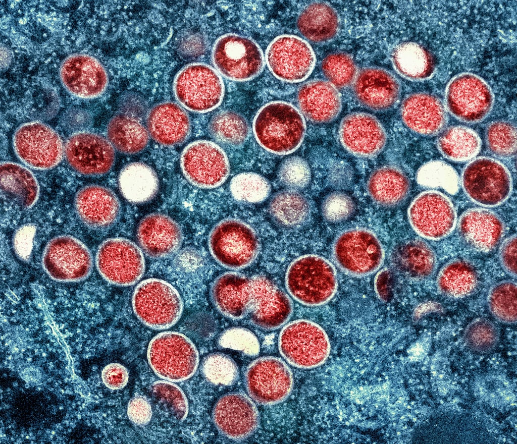 China tightens mpox controls