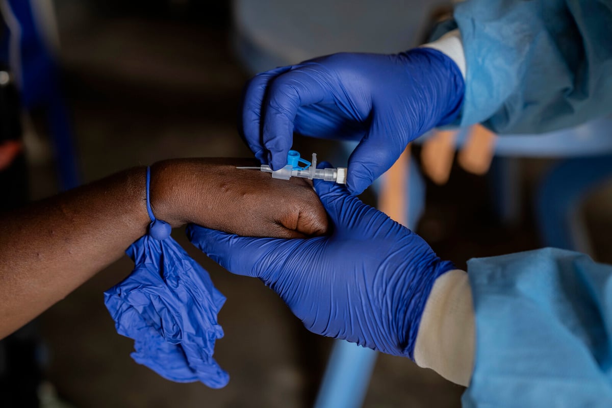 First Case of New Mpox in India
