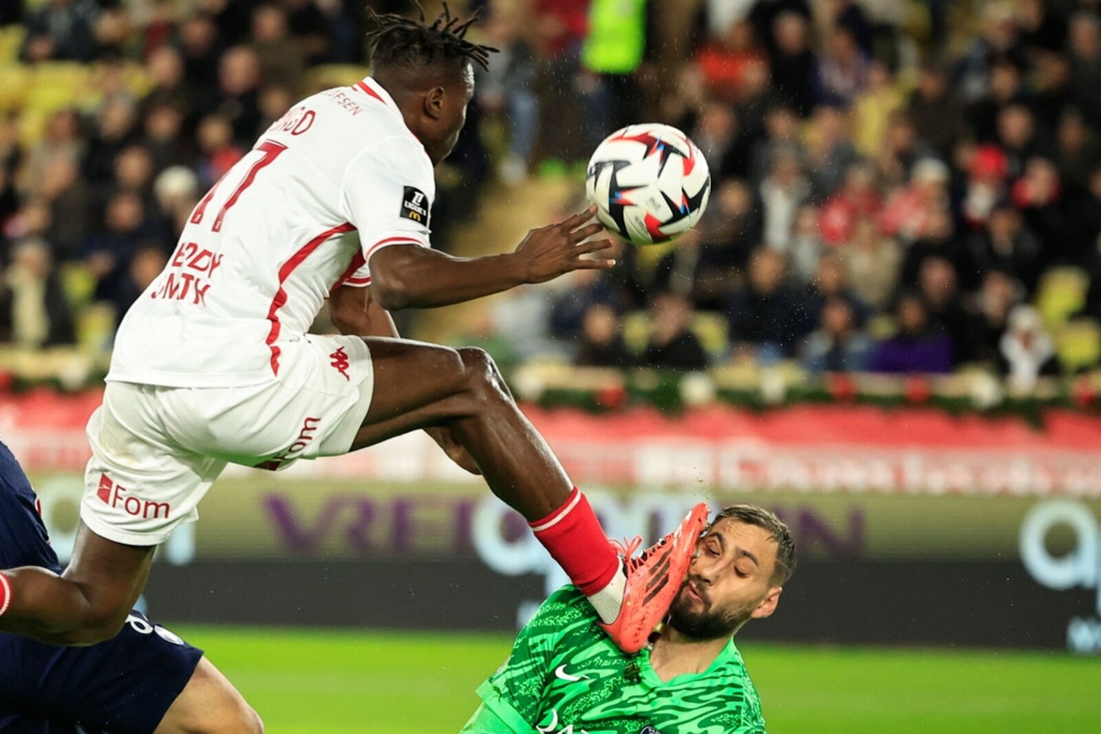 Got hit in the face – PSG goalkeeper injured